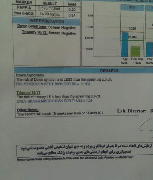 عکس غربالگری اول جنین پسر نی نی سایت