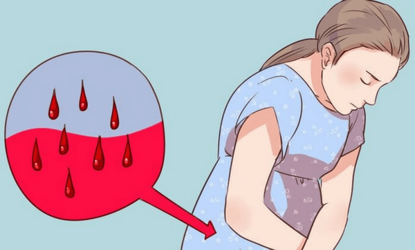 عکس از لکه بینی در اوایل بارداری