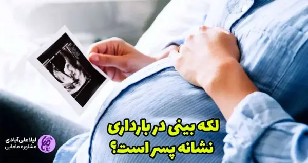 عکس از لکه بینی در اوایل بارداری