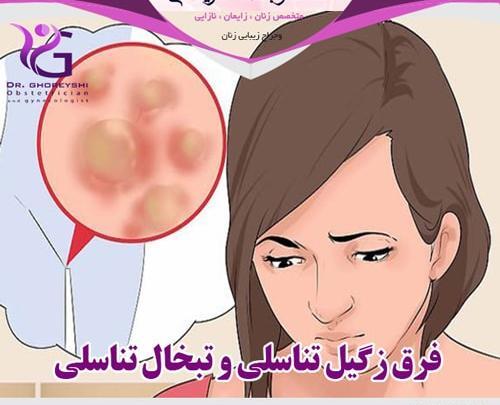 عکس ویروس هرپس تناسلی