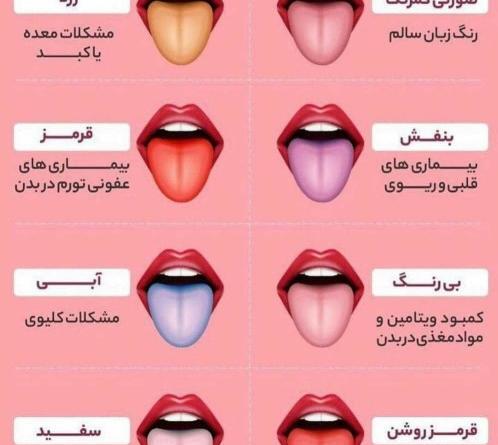 عکس سفیدی زبان