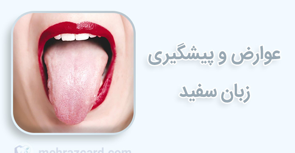 عکس سفیدی زبان