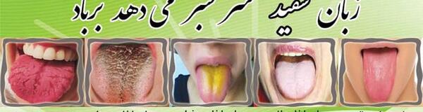 عکس سفیدی زبان