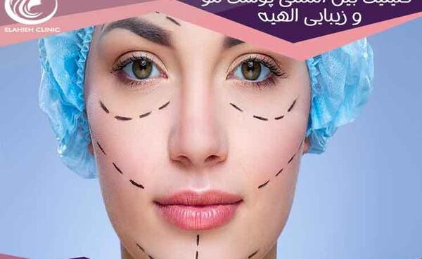 عکس ساره بیات برای پروفایل