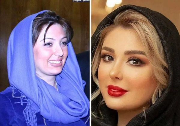 عکس روشا ضیغمی قبل از عمل