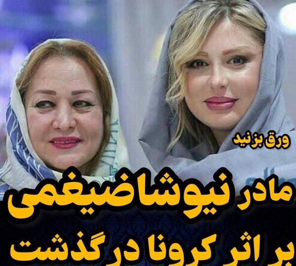 عکس روشا ضیغمی قبل از عمل