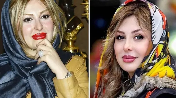 عکس روشا ضیغمی قبل از عمل