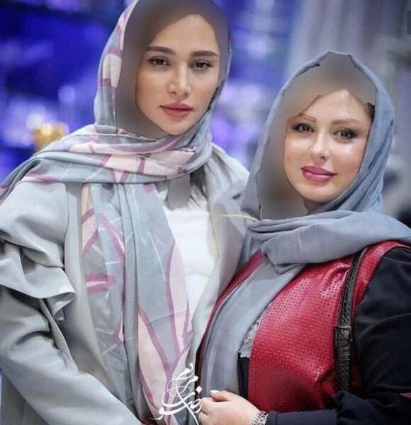 عکس روشا ضیغمی قبل از عمل