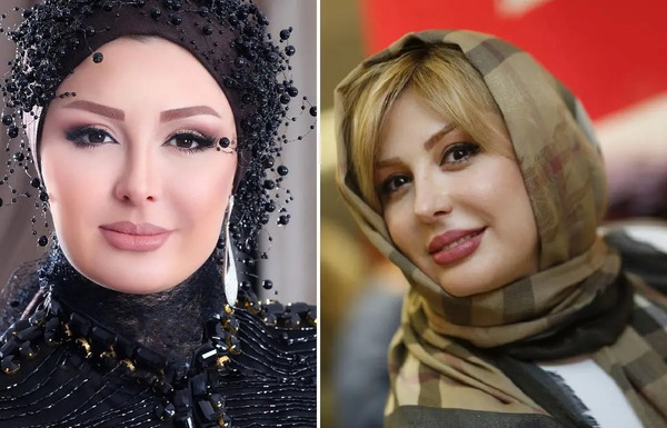 عکس روشا ضیغمی قبل از عمل