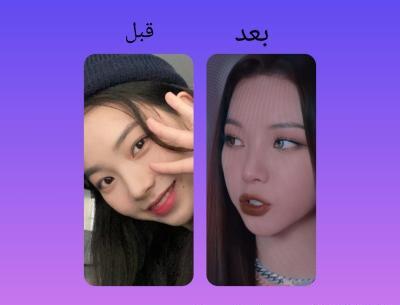 عکس اعضای گروه اکسو قبل از عمل