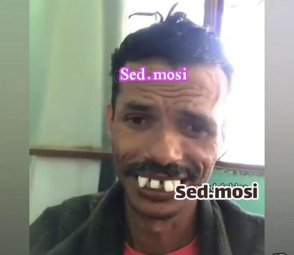 عکس مستر دندون