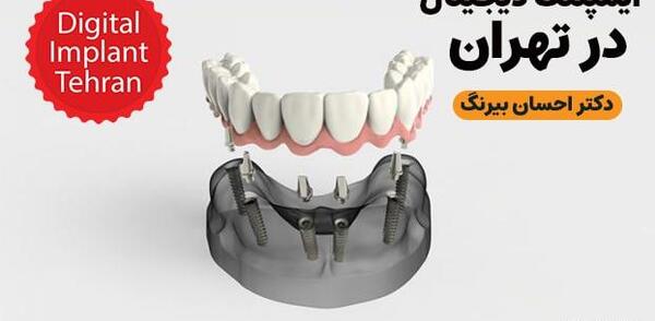 عکس مستر دندون