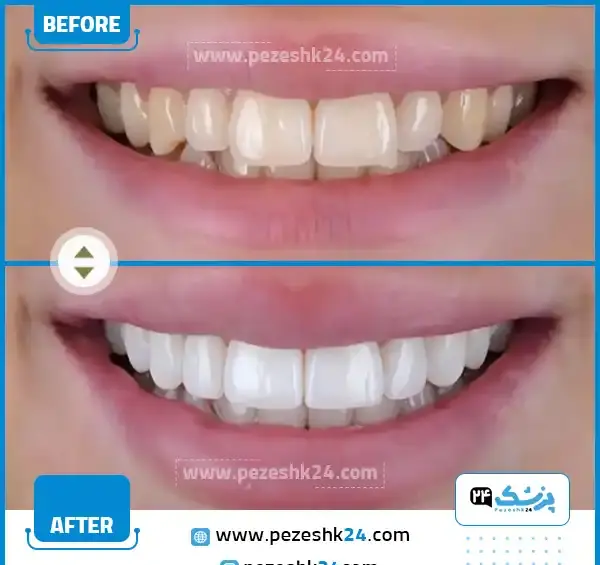 عکس مستر دندون