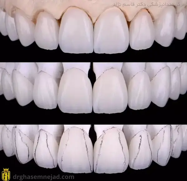 عکس مستر دندون