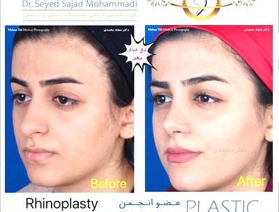 عکس سجاد تاتلس