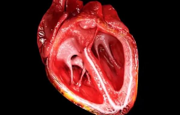 عکس تپش قلب کارتونی