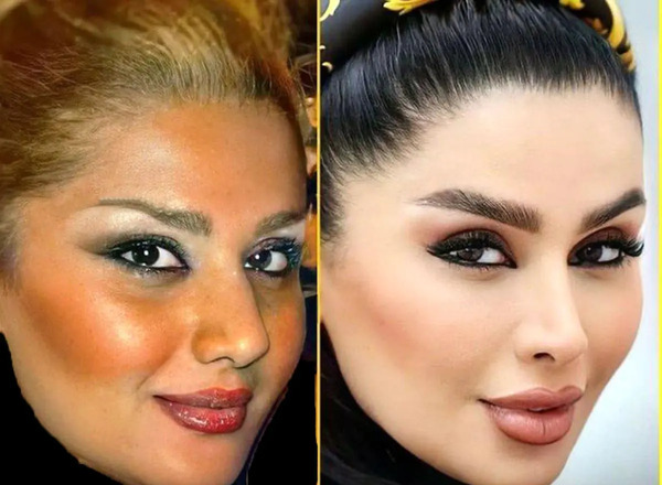 عکس ناخن دنیا جهانبخت