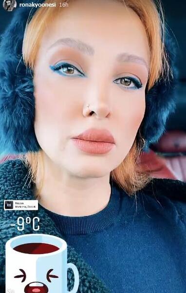 عکس سمیرا یونسی