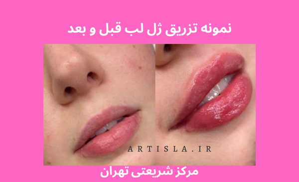 عکس سوتی لب نی نی سایت