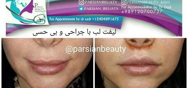 عکس سوتی لب نی نی سایت