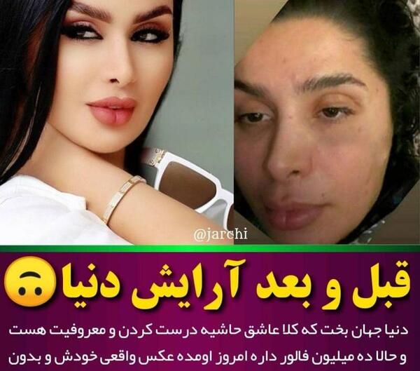 عکس بدون عمل دنیا جهانبخت