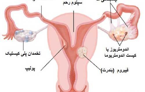 نی نی سایت عکس رنگی رحم