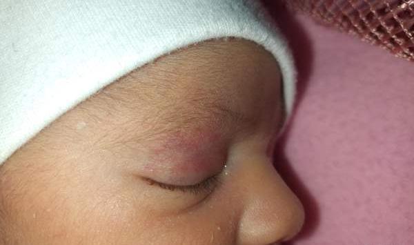 عکس خال نی نی سایت