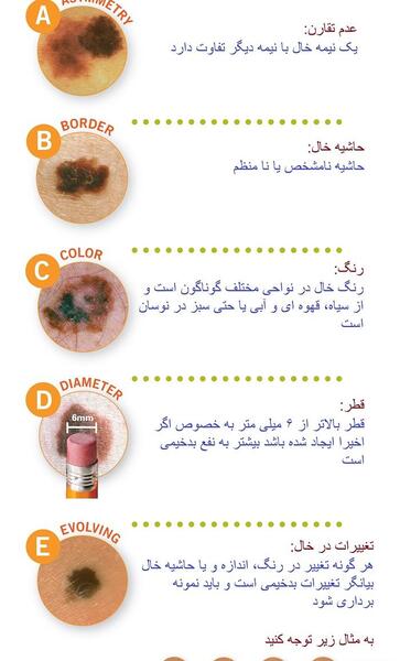 عکس خال نی نی سایت