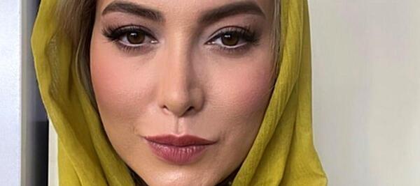 عکسهای فریبا نادری قبل از جراحی بینی