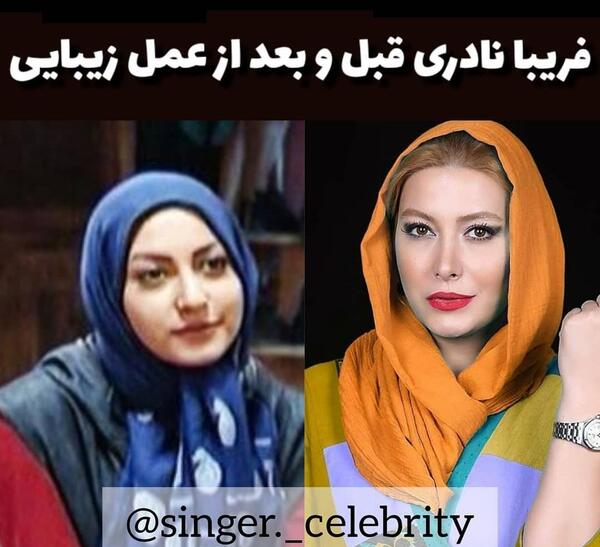 عکسهای فریبا نادری قبل از جراحی بینی