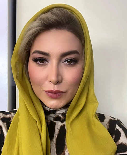 عکسهای فریبا نادری قبل از جراحی بینی