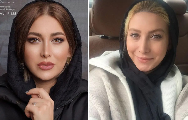 عکسهای فریبا نادری قبل از جراحی بینی