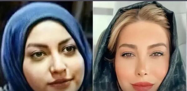 عکسهای فریبا نادری قبل از جراحی بینی