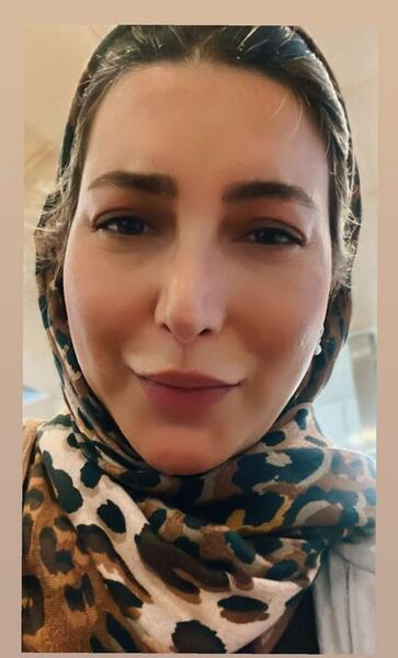 عکسهای فریبا نادری قبل از جراحی بینی