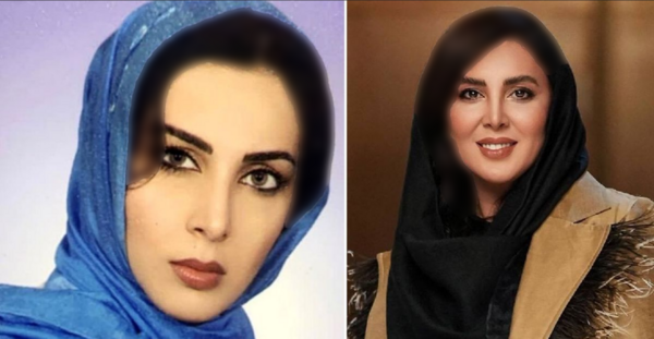 عکس لیلا قبل از عمل در سیب ممنوعه