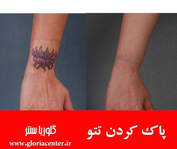 عکس تاتو زدن
