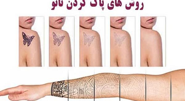 عکس تاتو زدن