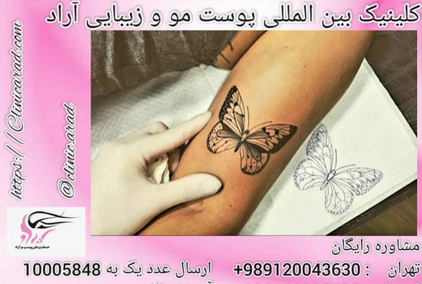 عکس تاتو زدن