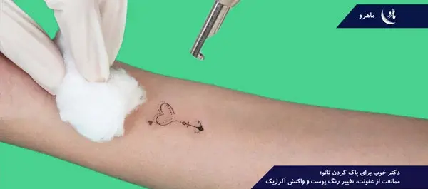 عکس تاتو زدن