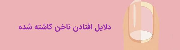 عکس ناخن افتاده