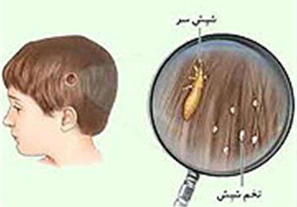 عکس شپش فیلم