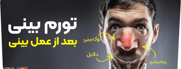 عکس آتلیه برای جراحی بینی
