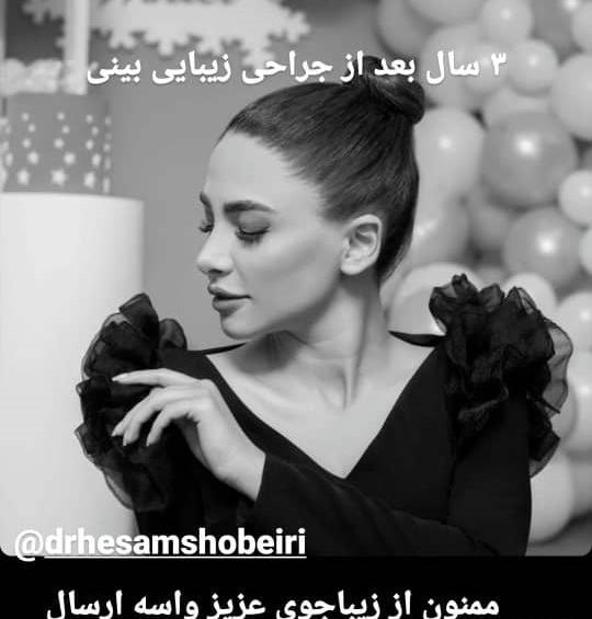 عکس آتلیه برای جراحی بینی