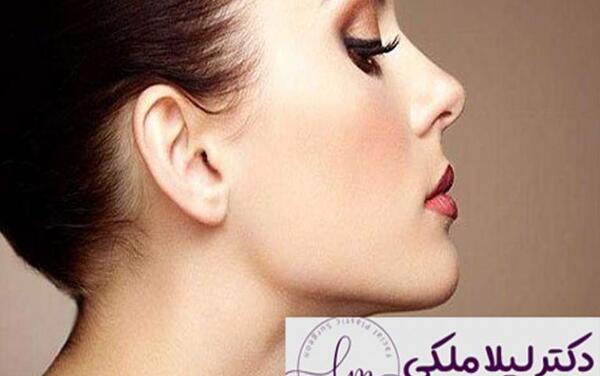 عکس آتلیه برای جراحی بینی