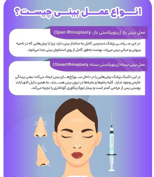 عکس آتلیه برای جراحی بینی