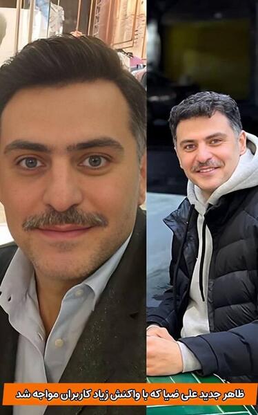 عکس اینستا علی ضیا