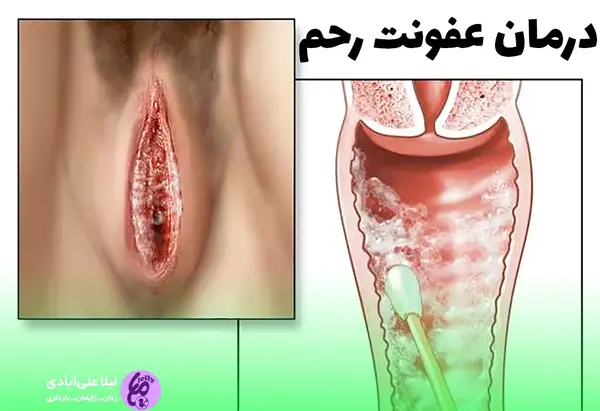 عکس داخل رحم انسان