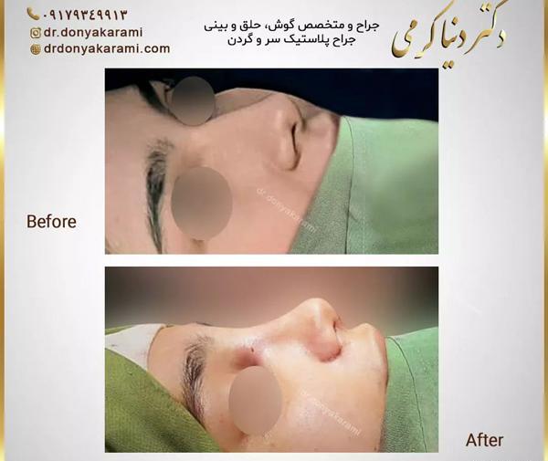 عکس دنیا کریمی