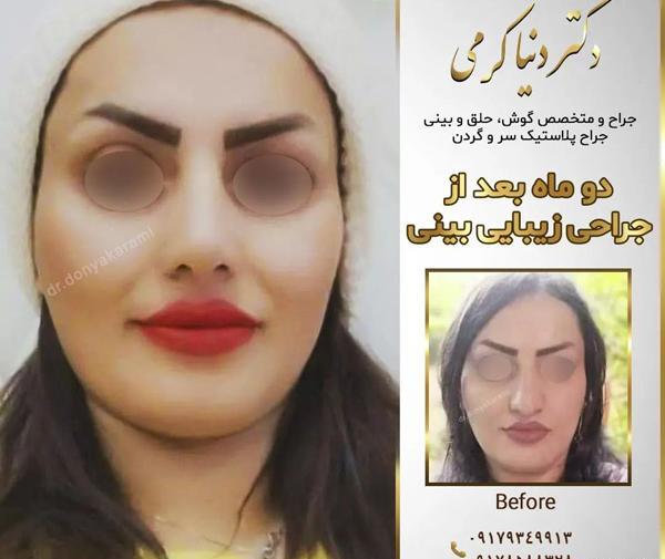 عکس دنیا کریمی