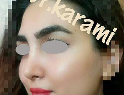 عکس دنیا کریمی
